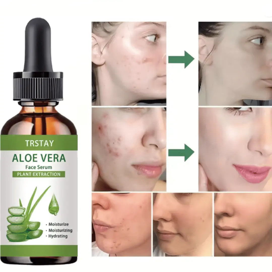 Suero Facial Antiedad de Aloe Vera con Vitamina E | Esencia Facial Hidratante, Iluminadora y Humectante de Aloe Vera Orgánico para Manchas Oscuras y Arrugas